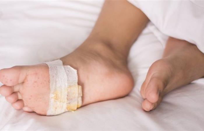 خبراء يكشفون العلاقة بين العناية بالأقدام والإصابة بالمرض السكري - بوراق نيوز